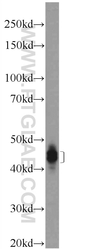 Western Blot (WB) analysis of rat brain tissue using Dematin Polyclonal antibody (16808-1-AP)