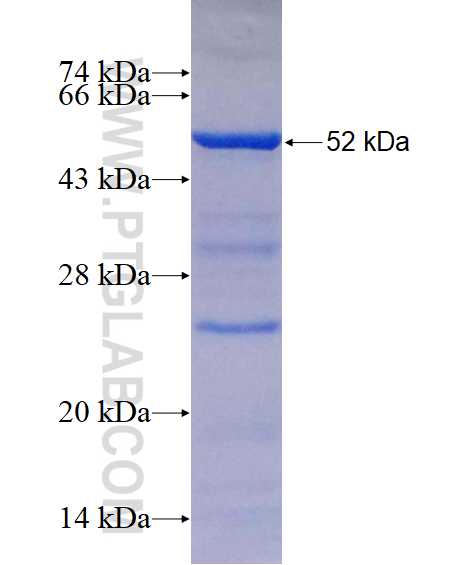 EPB49 fusion protein Ag10300 SDS-PAGE