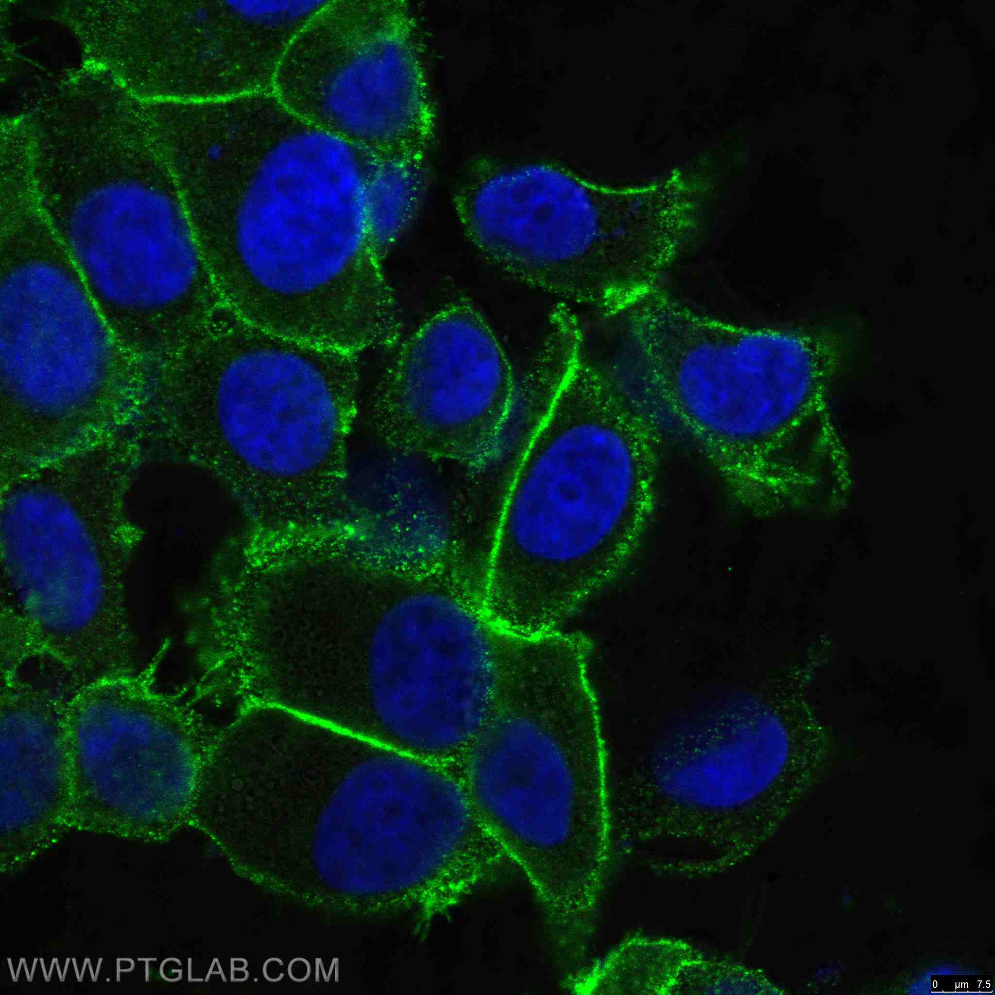 Immunofluorescence (IF) / fluorescent staining of MCF-7 cells using EPCAM/CD326 Polyclonal antibody (21050-1-AP)