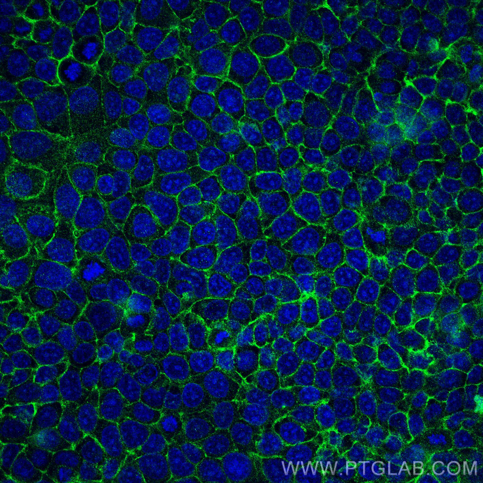 Immunofluorescence (IF) / fluorescent staining of MCF-7 cells using EPCAM/CD326 Polyclonal antibody (21050-1-AP)
