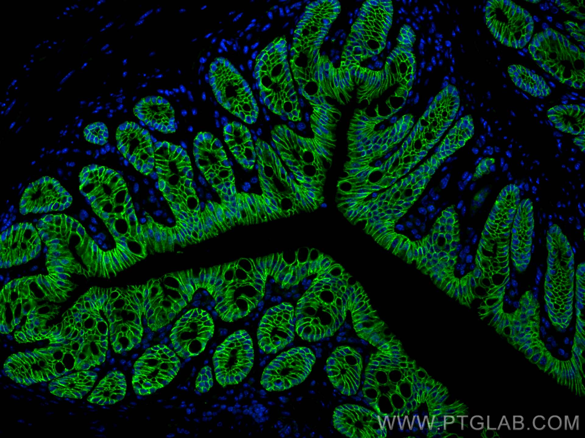 Immunofluorescence (IF) / fluorescent staining of mouse colon tissue using EPCAM/CD326 Polyclonal antibody (21050-1-AP)