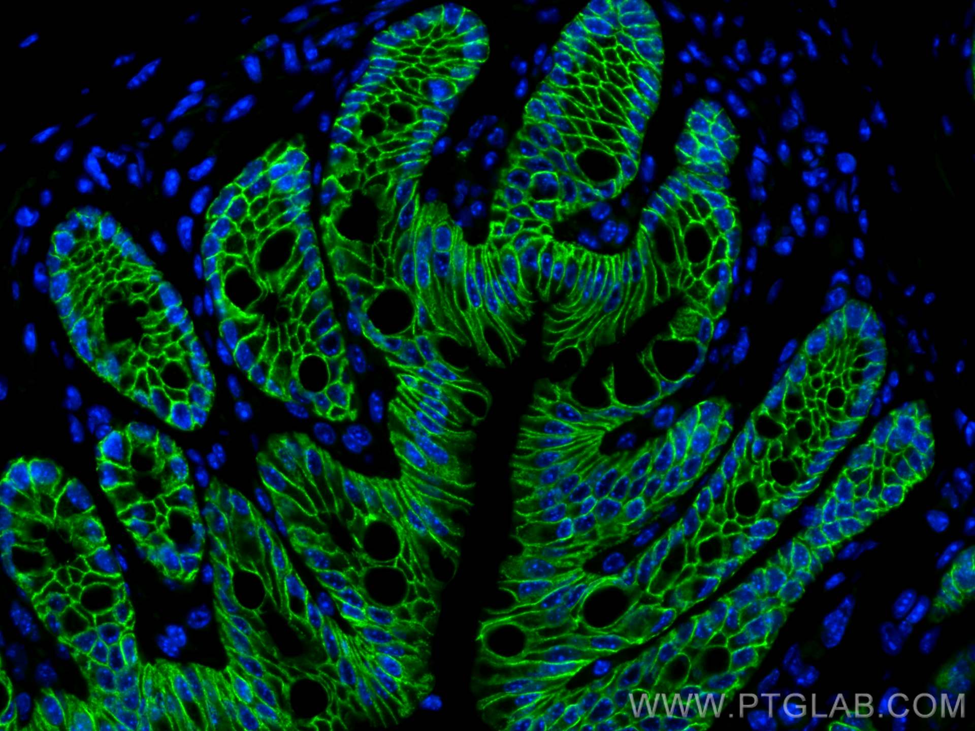 Immunofluorescence (IF) / fluorescent staining of mouse colon tissue using EPCAM/CD326 Polyclonal antibody (21050-1-AP)