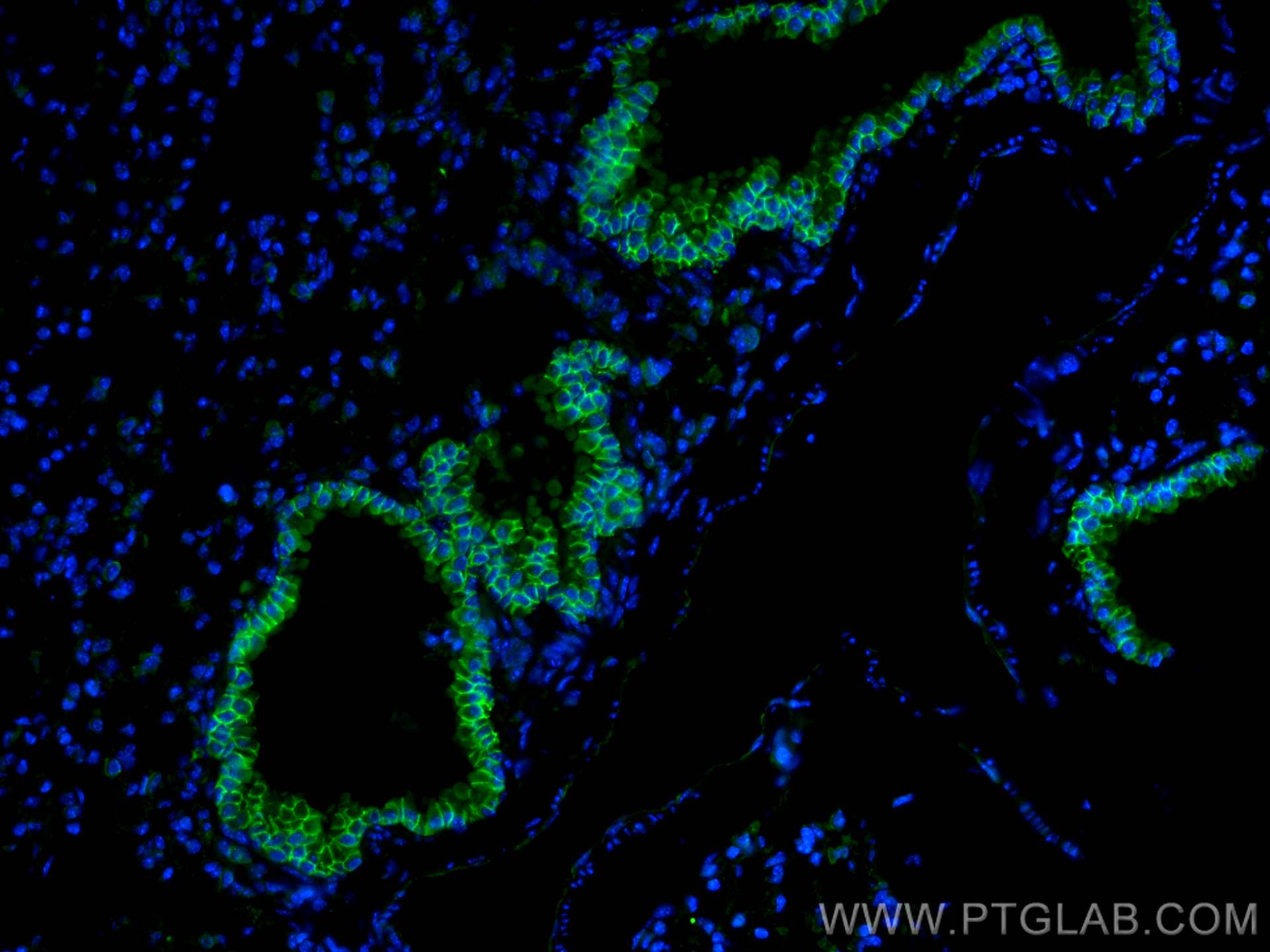 Immunofluorescence (IF) / fluorescent staining of mouse lung tissue using EPCAM/CD326 Polyclonal antibody (21050-1-AP)