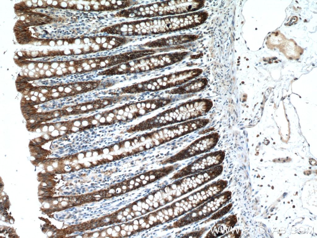 IHC staining of human colon using 21050-1-AP