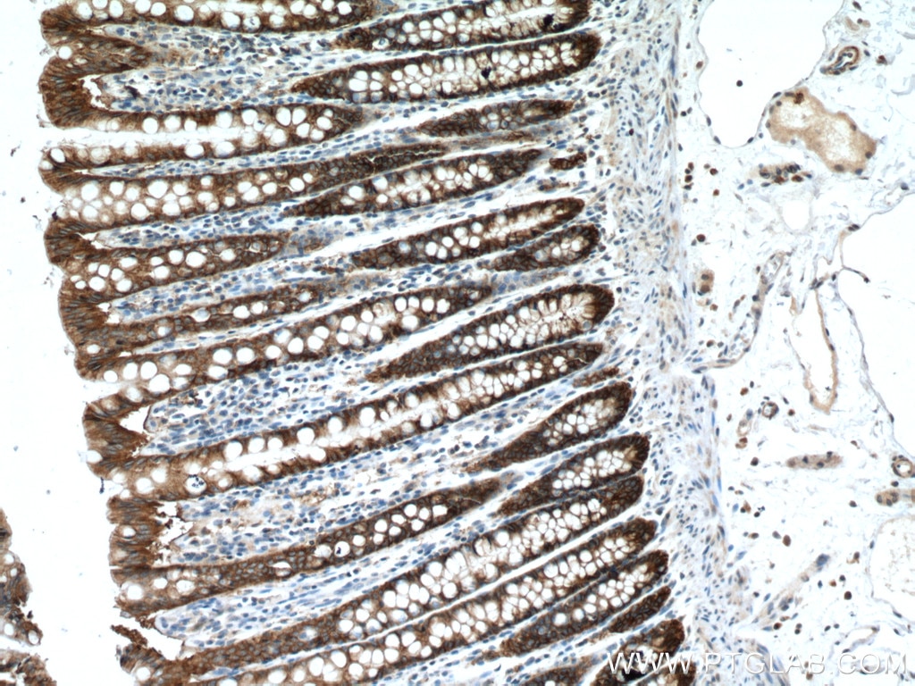 Immunohistochemistry (IHC) staining of human colon tissue using EPCAM/CD326 Polyclonal antibody (21050-1-AP)