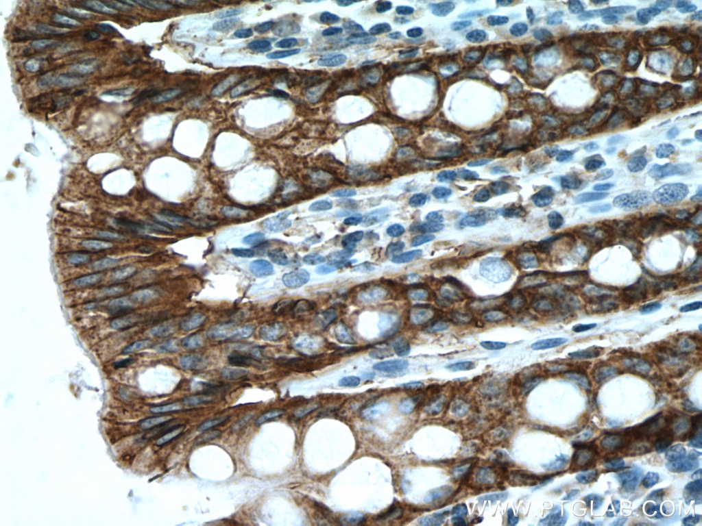 Immunohistochemistry (IHC) staining of human colon tissue using EPCAM/CD326 Polyclonal antibody (21050-1-AP)
