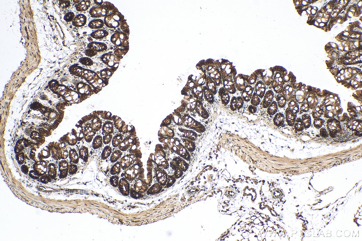 Immunohistochemistry (IHC) staining of mouse colon tissue using EPCAM/CD326 Polyclonal antibody (21050-1-AP)