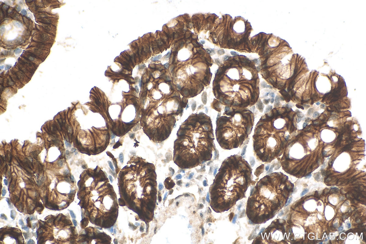 Immunohistochemistry (IHC) staining of mouse colon tissue using EPCAM/CD326 Polyclonal antibody (21050-1-AP)