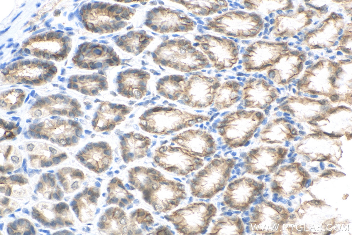 Immunohistochemistry (IHC) staining of mouse stomach tissue using EPCAM/CD326 Polyclonal antibody (21050-1-AP)