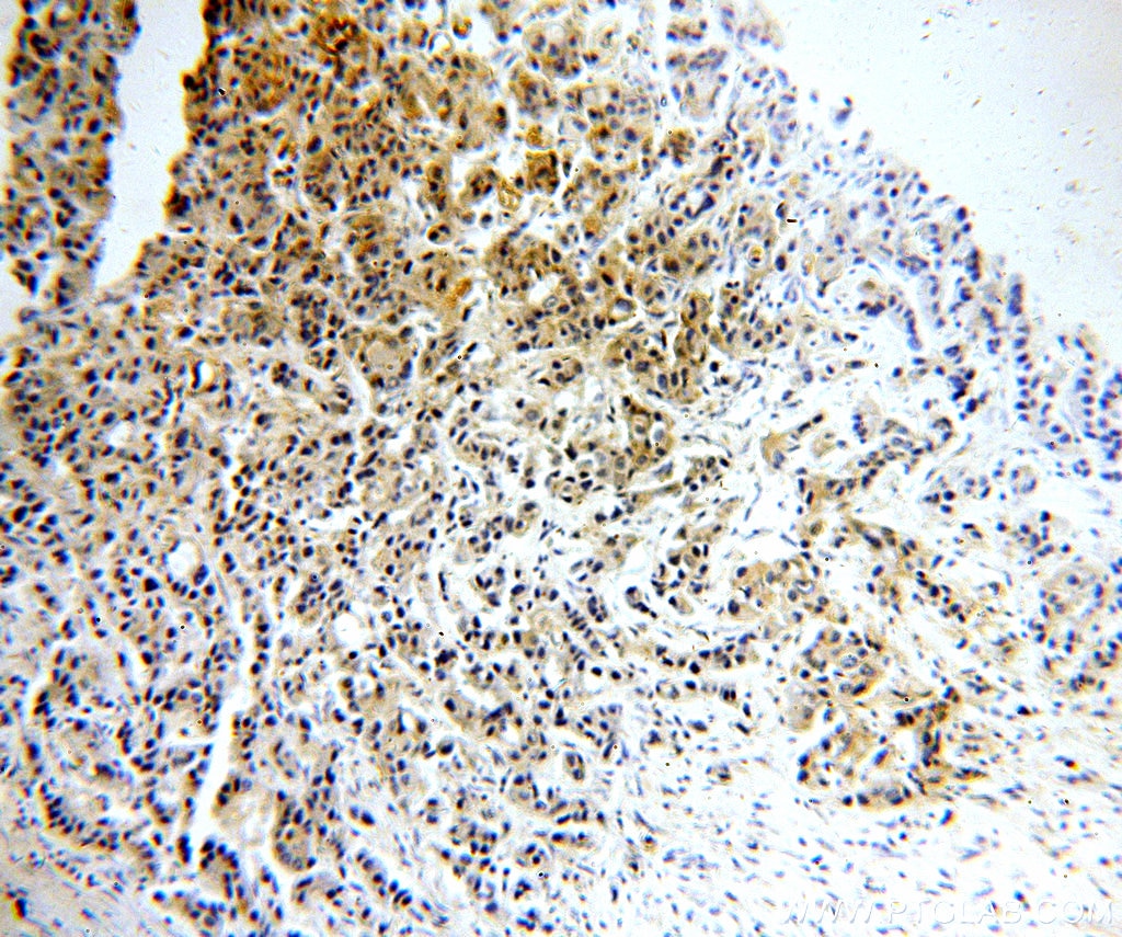 EPCAM/CD326 Polyclonal antibody