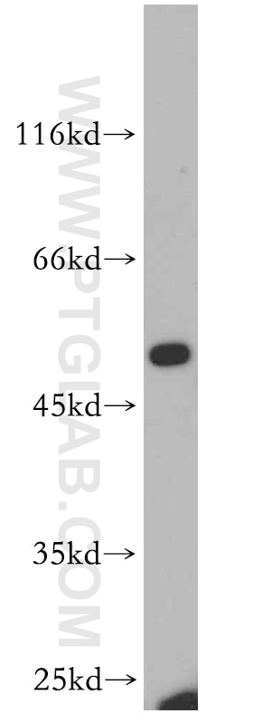 EPCAM/CD326 Polyclonal antibody