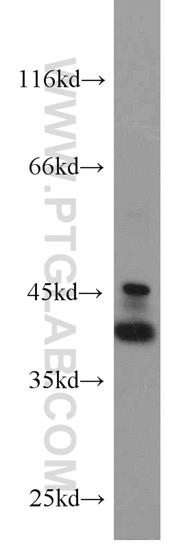 Western Blot (WB) analysis of MCF-7 cells using EPCAM/CD326 Polyclonal antibody (21050-1-AP)