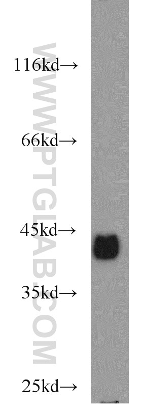 Western Blot (WB) analysis of mouse colon tissue using EPCAM/CD326 Polyclonal antibody (21050-1-AP)