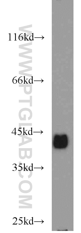 WB analysis of mouse colon using 21050-1-AP