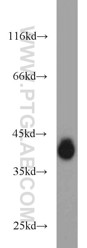 Western Blot (WB) analysis of A431 cells using EPCAM/CD326 Polyclonal antibody (21050-1-AP)