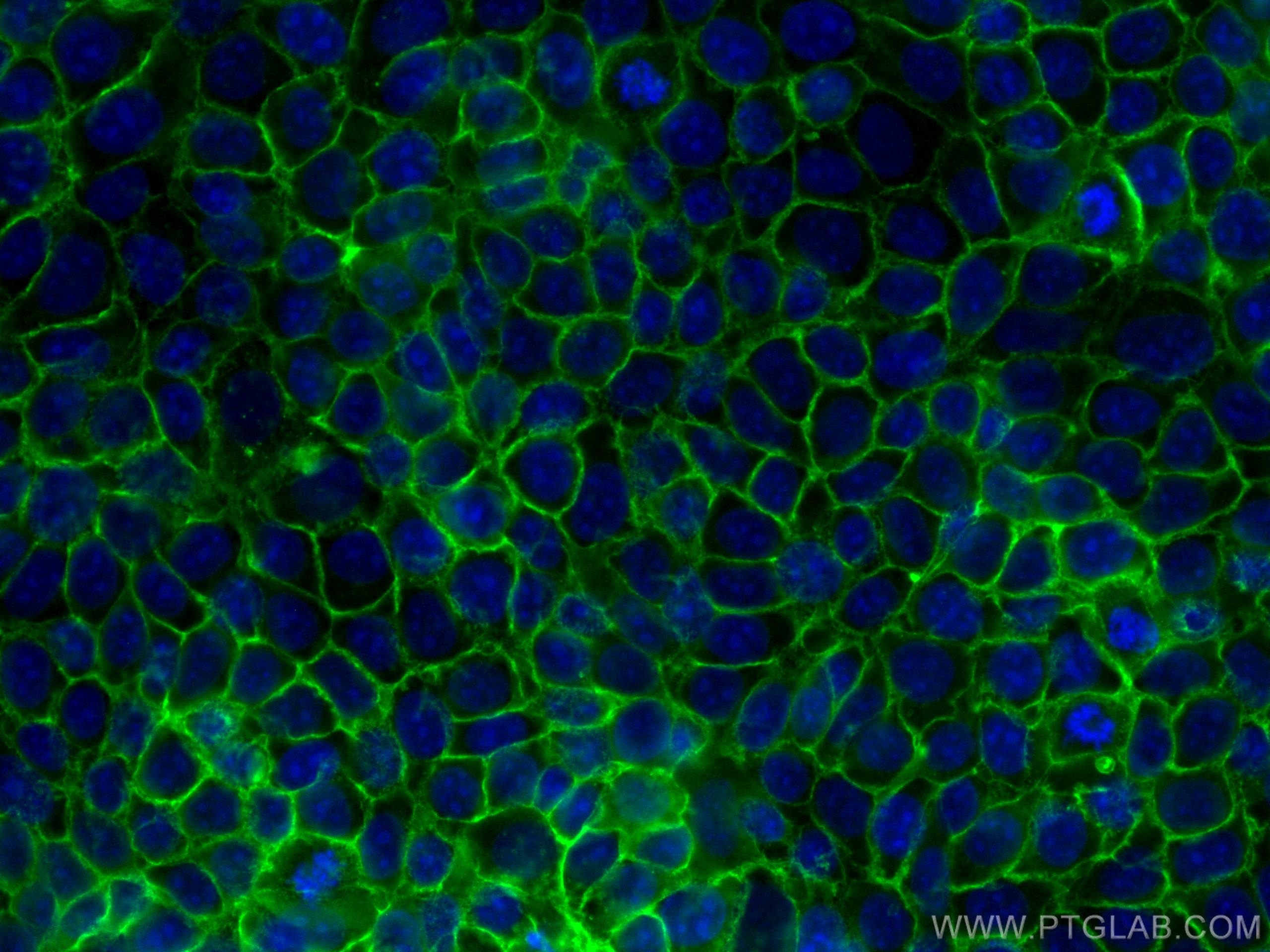 Immunofluorescence (IF) / fluorescent staining of MCF-7 cells using EPCAM/CD326 Monoclonal antibody (66316-1-Ig)