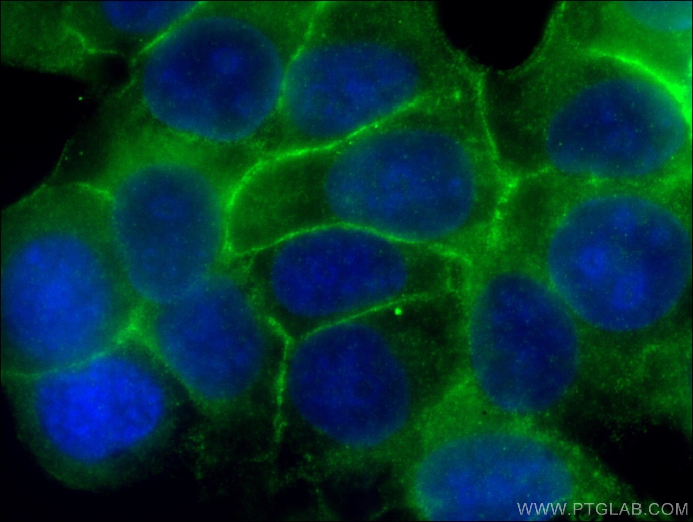 EPCAM/CD326 Monoclonal antibody