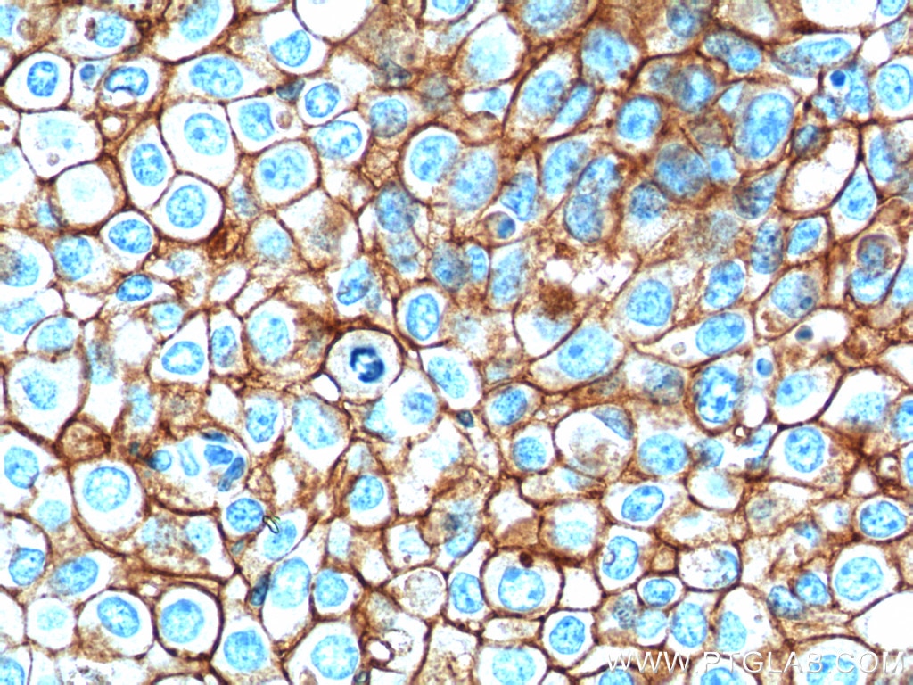 EPCAM/CD326 Monoclonal antibody