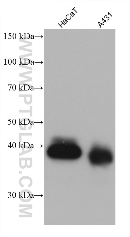 Western Blot (WB) analysis of various lysates using EPCAM/CD326 Monoclonal antibody (66316-1-Ig)