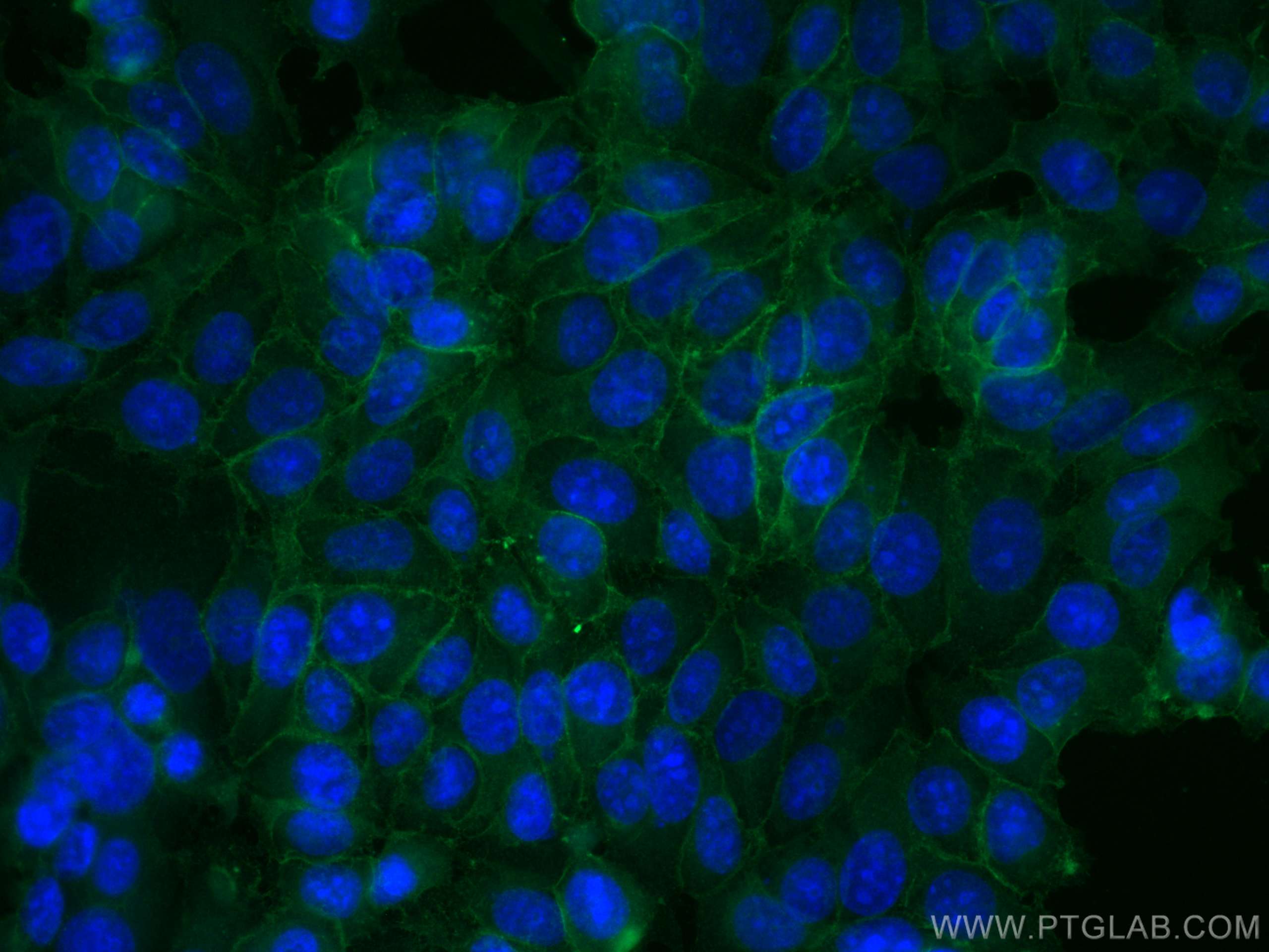 Immunofluorescence (IF) / fluorescent staining of MCF-7 cells using CoraLite® Plus 488-conjugated EPCAM/CD326 Monoclon (CL488-66316)