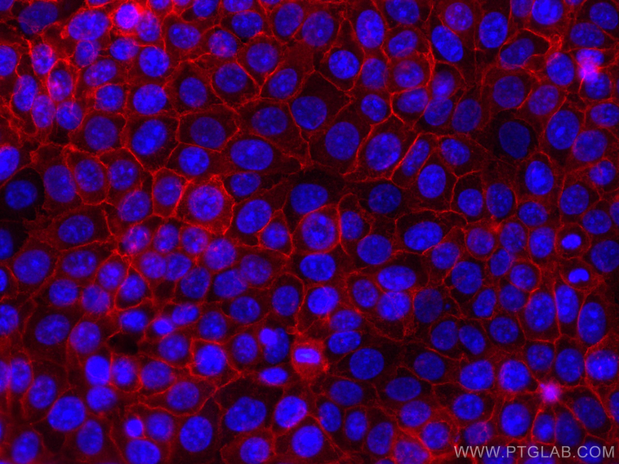 Immunofluorescence (IF) / fluorescent staining of MCF-7 cells using CoraLite®594-conjugated EPCAM/CD326 Monoclonal ant (CL594-66316)