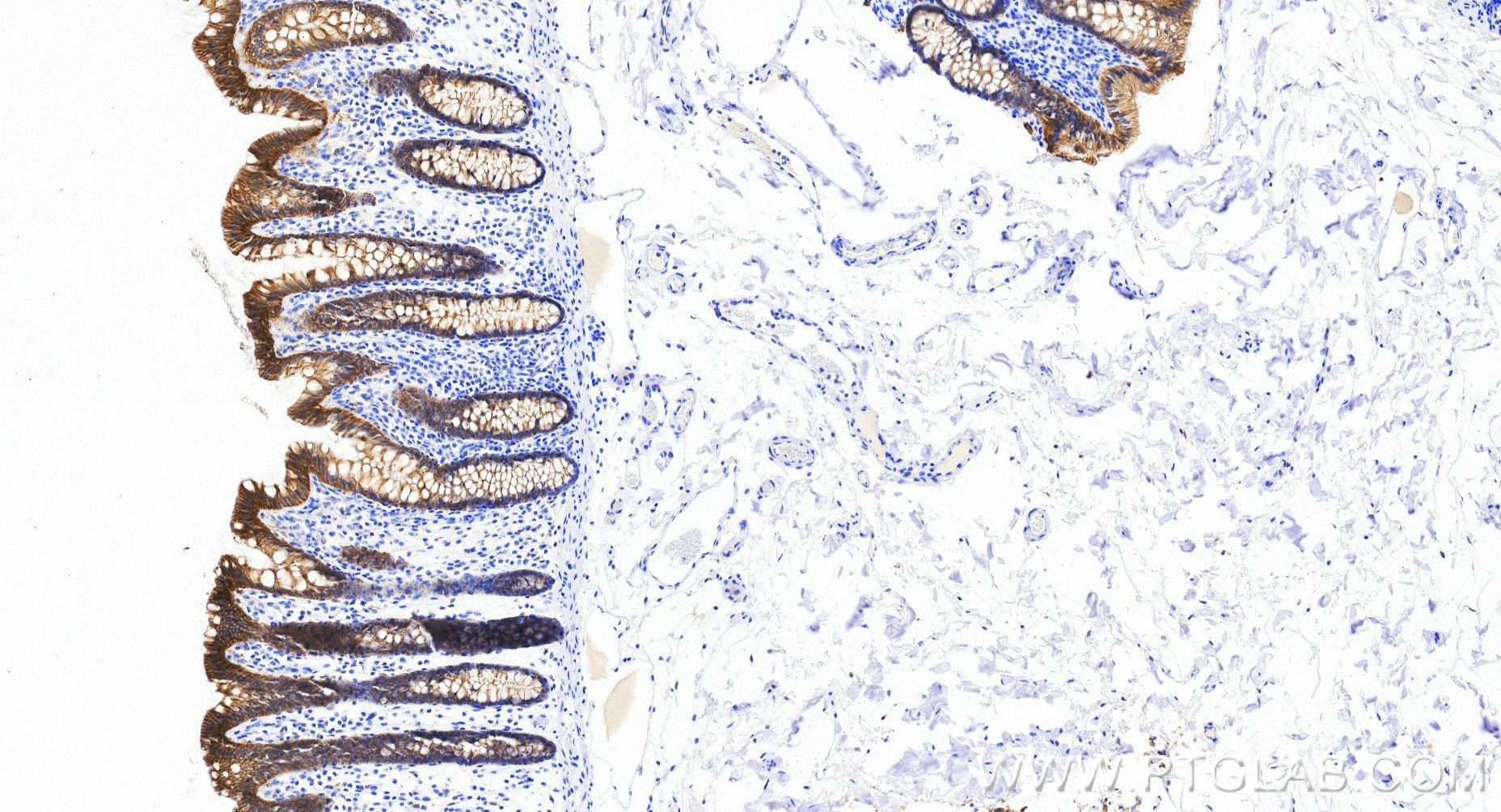 Immunohistochemistry (IHC) staining of human colon tissue using EPCAM/CD326 Recombinant monoclonal antibody (84073-11-RR)