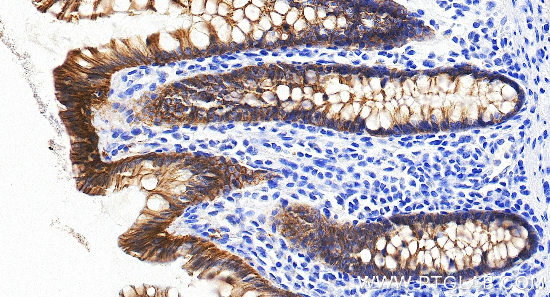 Immunohistochemistry (IHC) staining of human colon tissue using EPCAM/CD326 Recombinant monoclonal antibody (84073-11-RR)