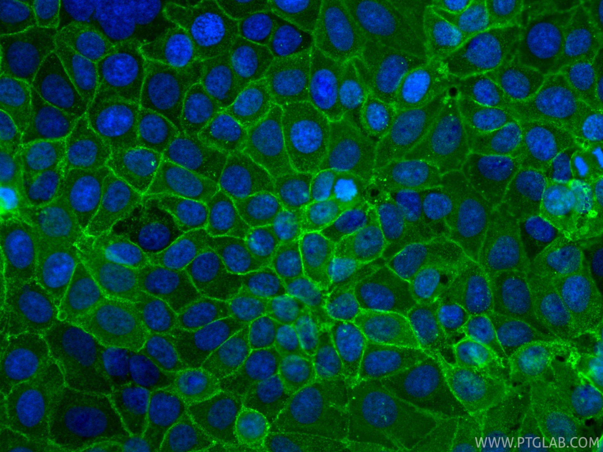 Immunofluorescence (IF) / fluorescent staining of MCF-7 cells using EPCAM/CD326 Recombinant monoclonal antibody (84073-11-RR)