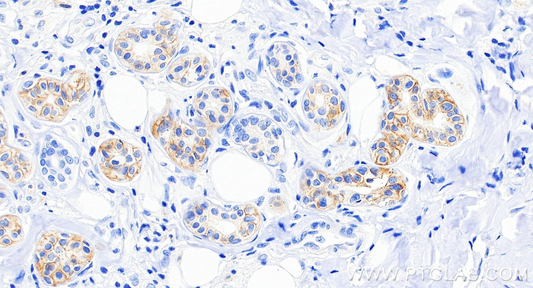 Immunohistochemistry (IHC) staining of human skin tissue using EPCAM/CD326 Recombinant monoclonal antibody (84073-11-RR)