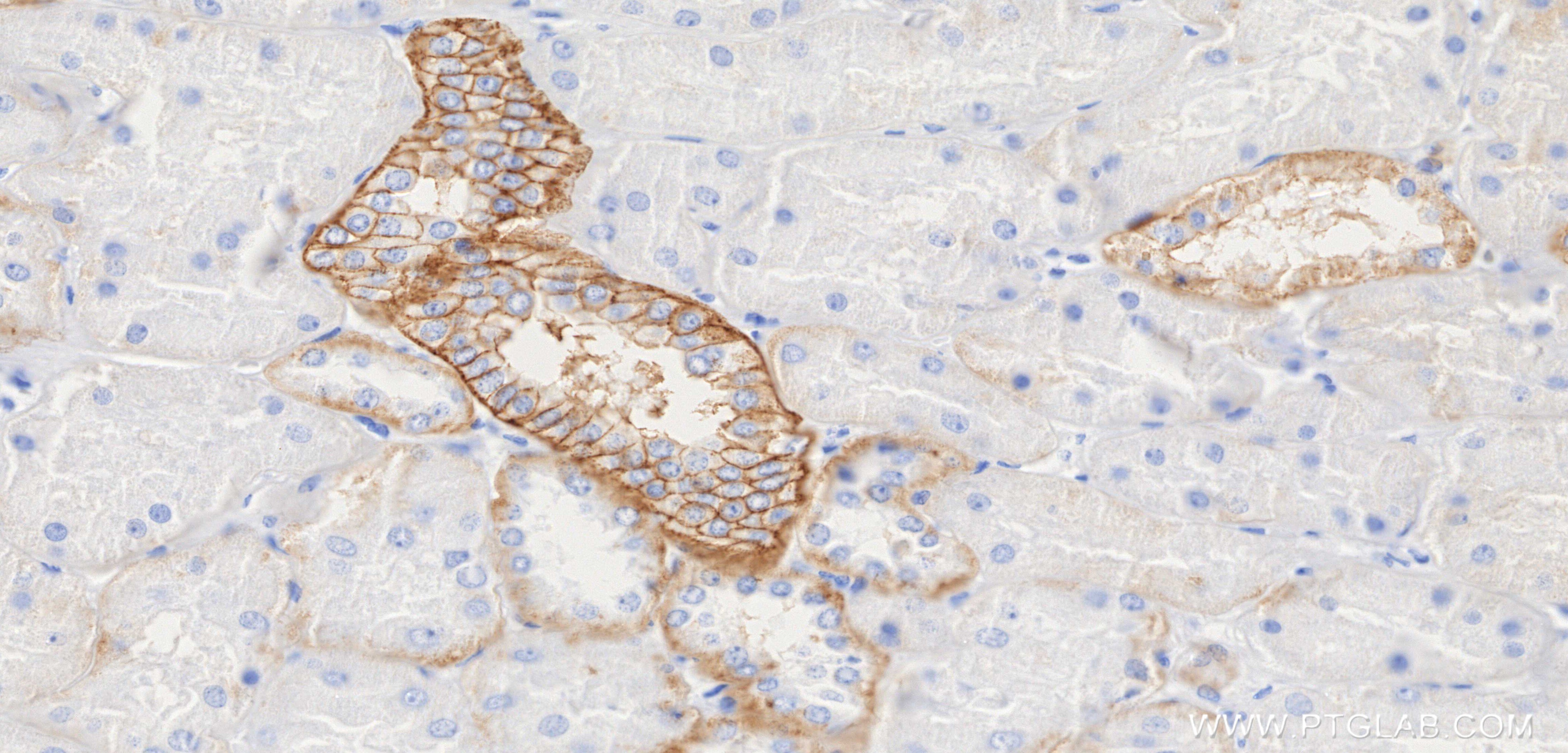 IHC staining of human kidney using 84073-6-RR Immunohistochemistry (IHC) staining of human kidney tissue using EPCAM/CD326 Recombinant monoclonal antibody (84073-6-RR)