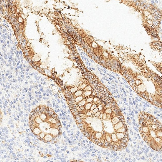 IHC staining of human appendicitis using 84073-6-RR Immunohistochemistry (IHC) staining of human appendicitis tissue using EPCAM/CD326 Recombinant monoclonal antibody (84073-6-RR)
