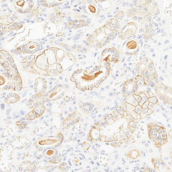 IHC staining of human kidney using 84073-6-RR Immunohistochemistry (IHC) staining of human kidney tissue using EPCAM/CD326 Recombinant monoclonal antibody (84073-6-RR)