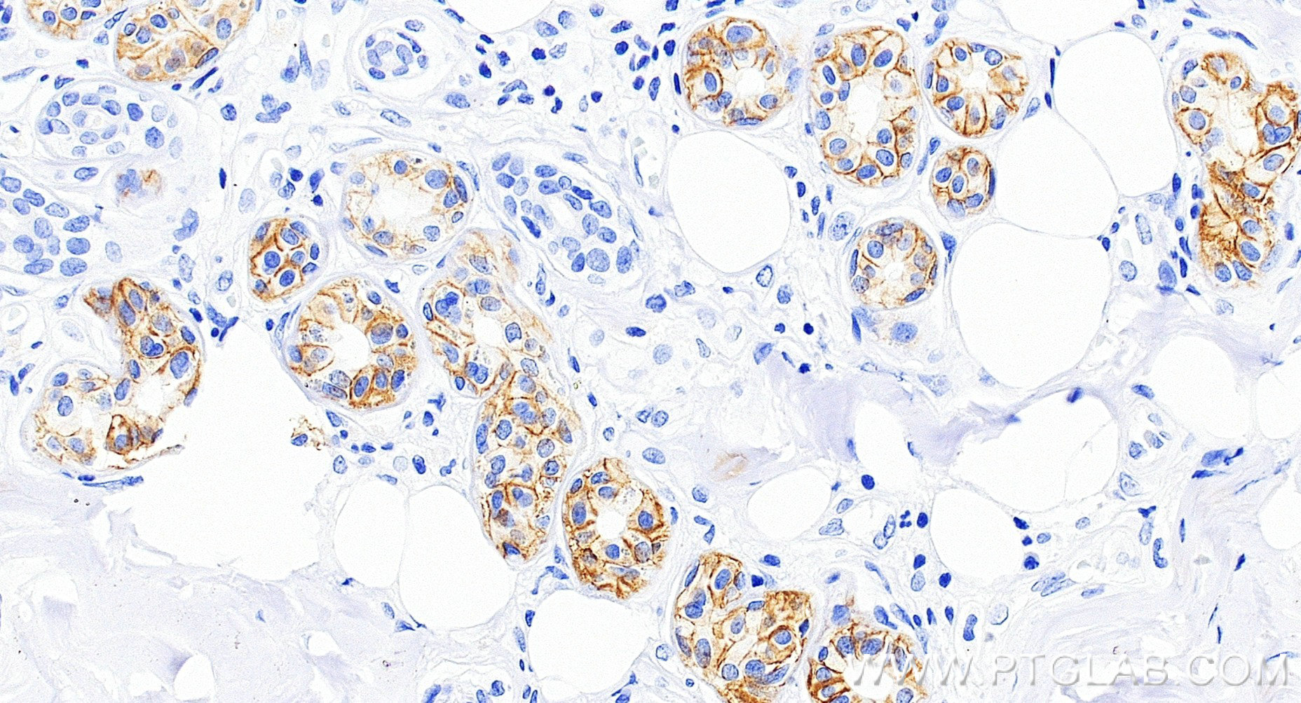 Immunohistochemistry (IHC) staining of human skin tissue using EPCAM/CD326 Recombinant monoclonal antibody (84073-6-RR)