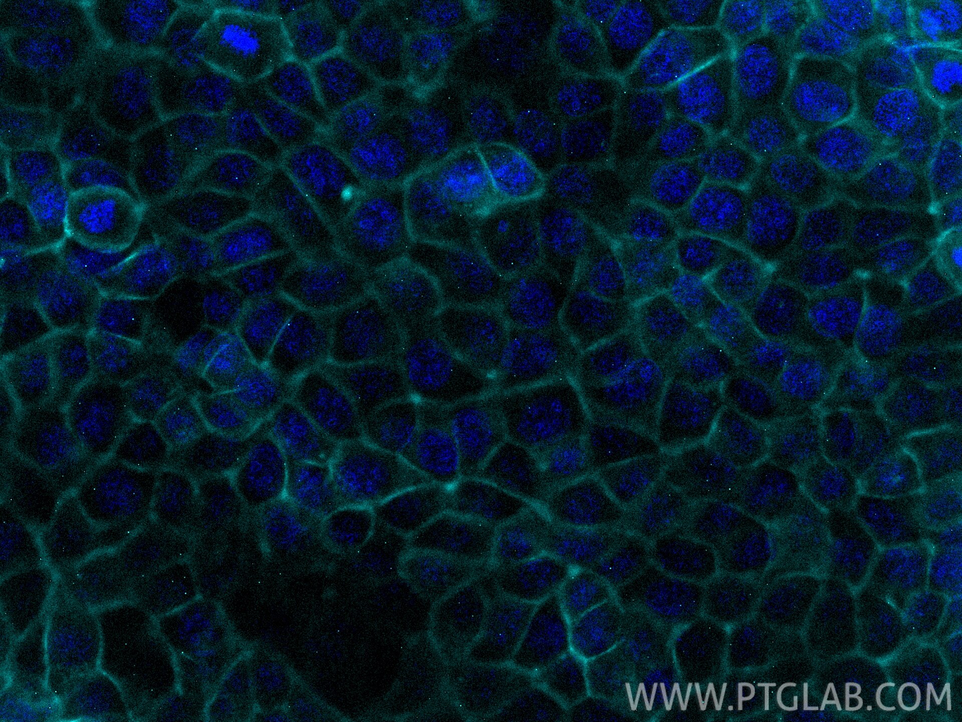 Immunofluorescent analysis of (-20°C Methanol) fixed MCF-7 cells using CoraLite® Plus 750 EPCAM/CD326 antibody (CL750-84073-6, Clone: 241243B10 ) at dilution of 1:200. Immunofluorescence (IF) / fluorescent staining of MCF-7 cells using CoraLite® Plus 750-conjugated EPCAM/CD326 Recombin (CL750-84073-6)
