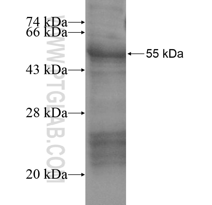 EPCAM fusion protein Ag15393 SDS-PAGE