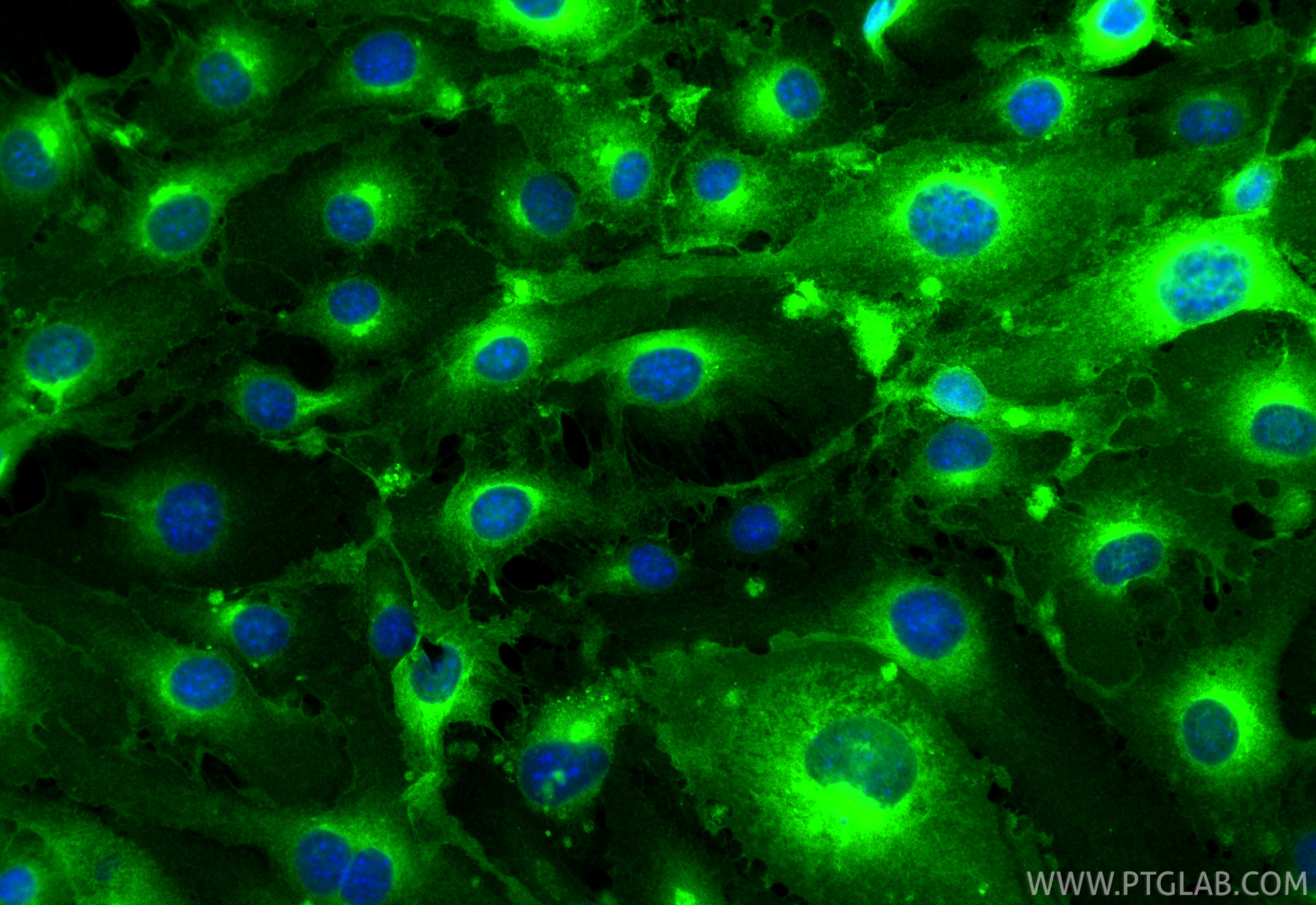 Immunofluorescence (IF) / fluorescent staining of bEnd.3 cells using CoraLite® Plus 488-conjugated EPCR/CD201 Recombina (CL488-84494-2)