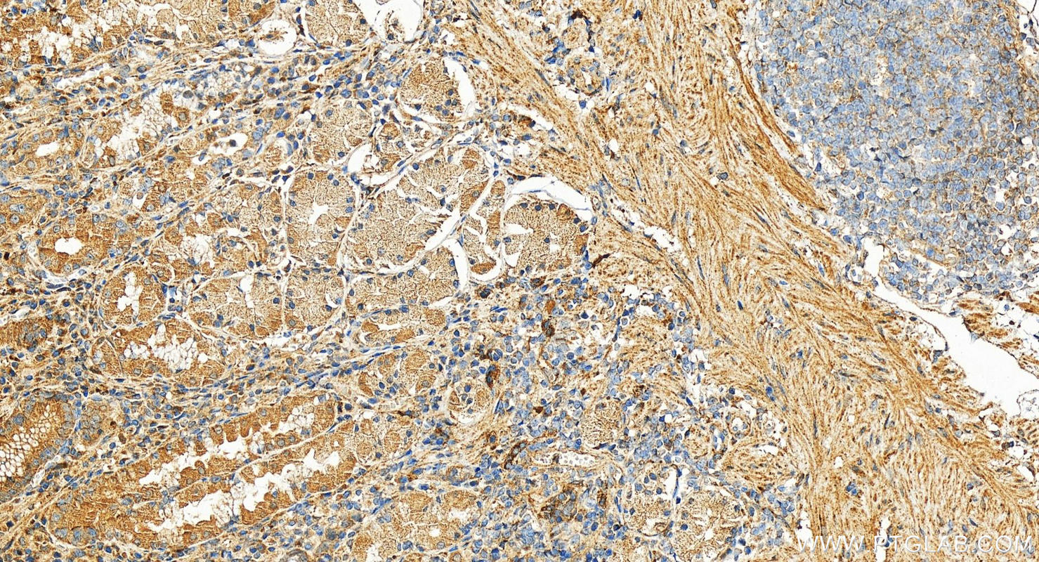 Immunohistochemistry (IHC) staining of human stomach tissue using EPDR1 Polyclonal antibody (27252-1-AP)
