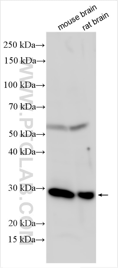 Western Blot (WB) analysis of various lysates using EPDR1 Polyclonal antibody (27252-1-AP)