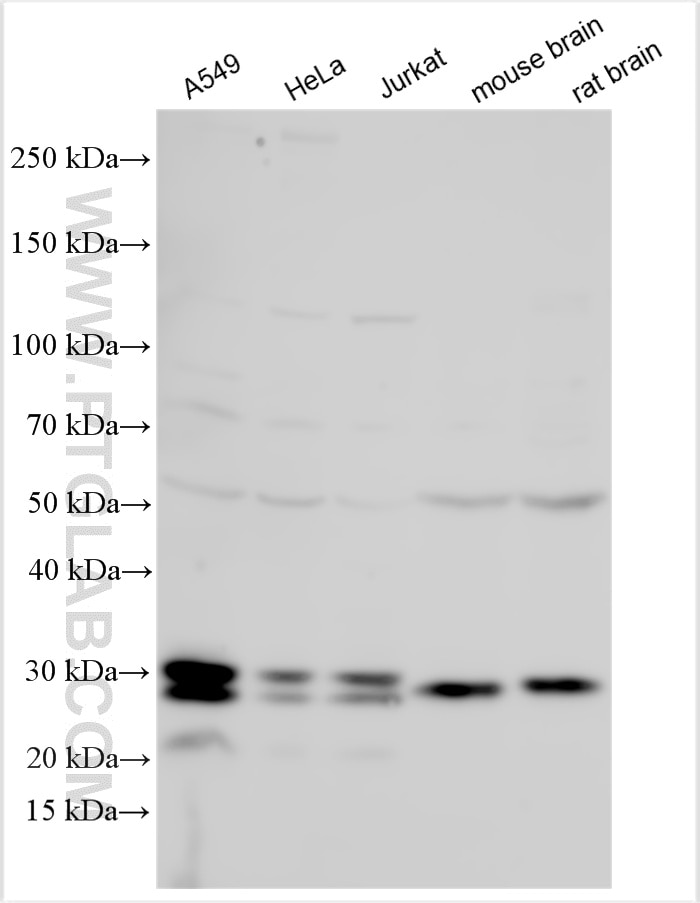 Western Blot (WB) analysis of various lysates using EPDR1 Polyclonal antibody (27252-1-AP)