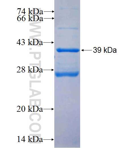 EPDR1 fusion protein Ag26120 SDS-PAGE