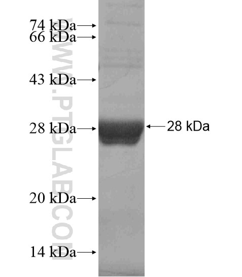 EPGN fusion protein Ag18899 SDS-PAGE