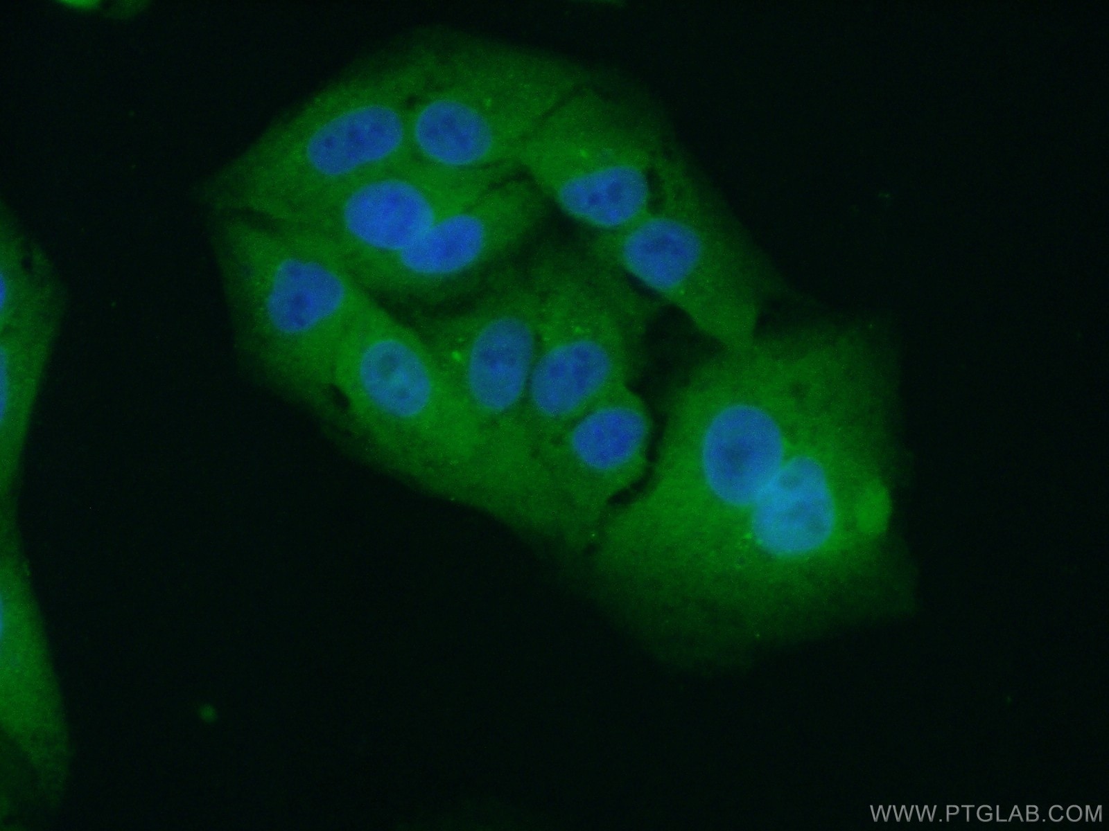 Immunofluorescence (IF) / fluorescent staining of A549 cells using EPHA1-specific Polyclonal antibody (18698-1-AP)