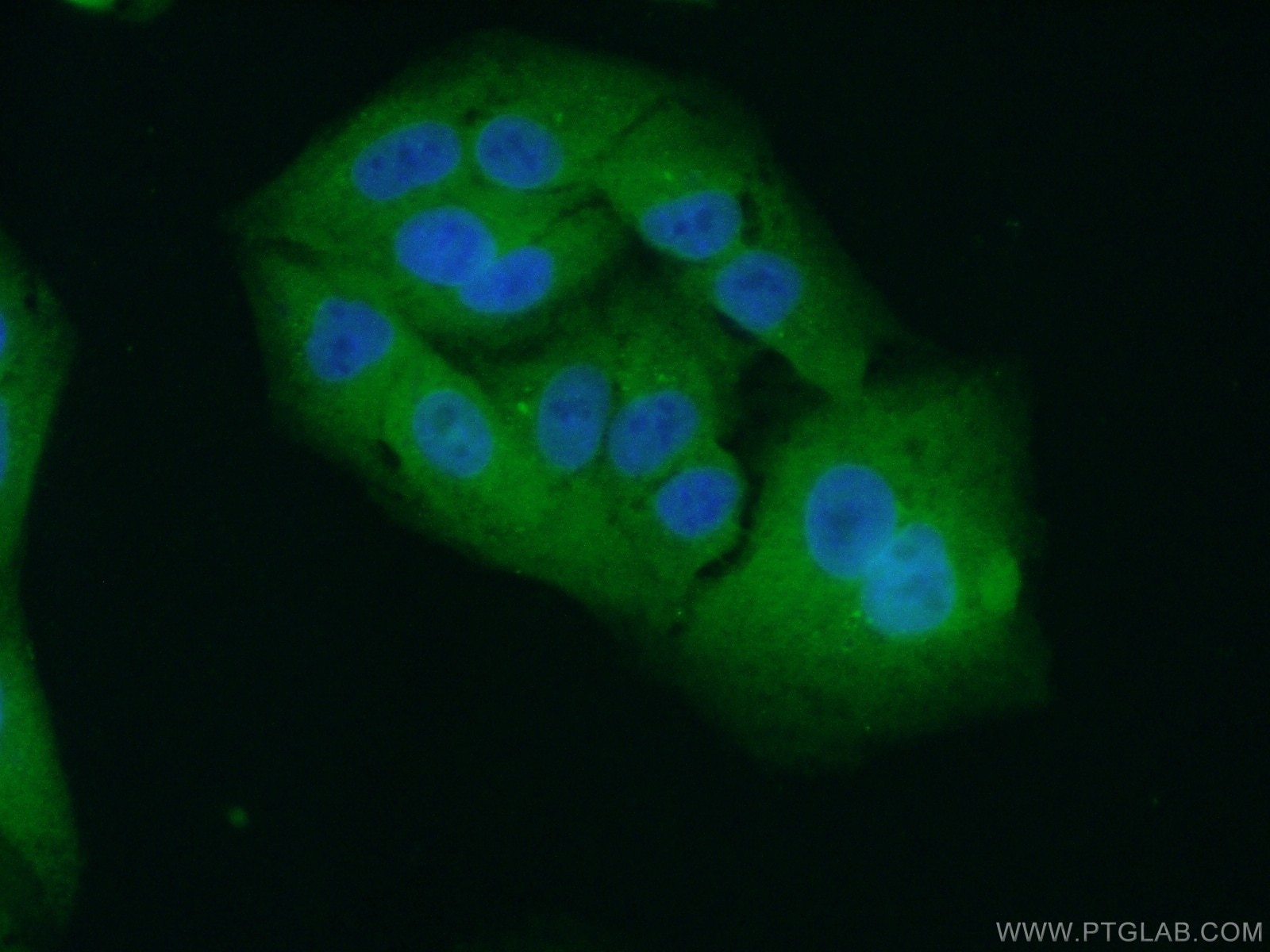 IF Staining of A549 using 18698-1-AP