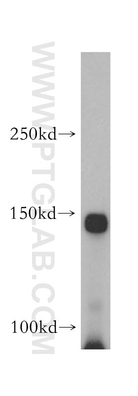 Western Blot (WB) analysis of HeLa cells using EPHA1-specific Polyclonal antibody (18698-1-AP)