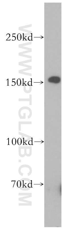 Western Blot (WB) analysis of A549 cells using EPHA1-specific Polyclonal antibody (18698-1-AP)