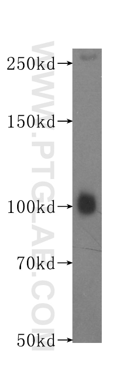 Western Blot (WB) analysis of A549 cells using EPHA1-special Monoclonal antibody (60155-1-Ig)