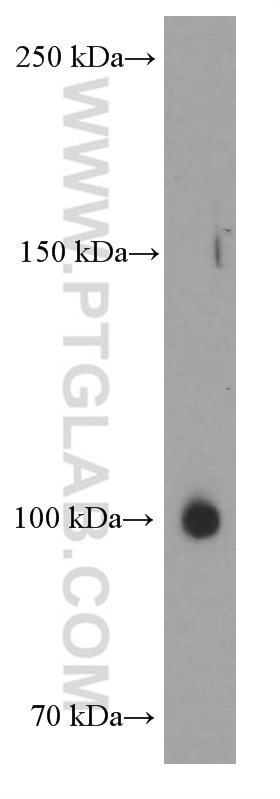Western Blot (WB) analysis of COLO 320 cells using EPHA1-specific Monoclonal antibody (60155-2-Ig)
