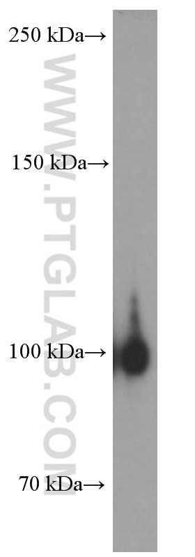 Western Blot (WB) analysis of HepG2 cells using EPHA1-specific Monoclonal antibody (60155-2-Ig)