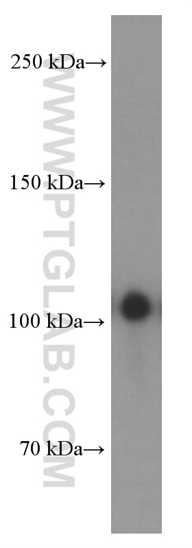 Western Blot (WB) analysis of HeLa cells using EPHA1-specific Monoclonal antibody (60155-2-Ig)