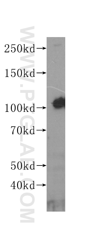 WB analysis of A549 using 60155-3-Ig Western Blot (WB) analysis of A549 cells using EPHA1-special Monoclonal antibody (60155-3-Ig)